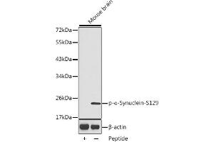 Western blot analysis of extracts from mouse brain tissue, using Phospho-α-Synuclein-S129 antibody (ABIN3020489, ABIN3020490, ABIN3020491 and ABIN1682058). (SNCA antibody  (pSer129))
