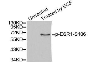 Western blot analysis of extracts from MCF7 cells, using Phospho-ESR1-S106 antibody (ABIN2988004). (Estrogen Receptor alpha antibody  (pSer106))