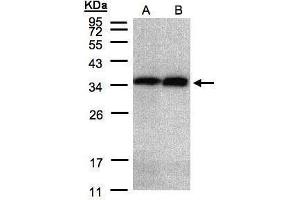 WB Image Sample(30 μg of whole cell lysate) A:HeLa S3, B:Hep G2, 12% SDS PAGE antibody diluted at 1:2000 (Annexin V antibody)