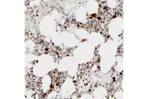 Immunohistochemical staining of human bone marrow with CDK6 polyclonal antibody  shows strong nuclear positivity in bone marrow poietic cells at 1:20-1:50 dilution. (CDK6 antibody)