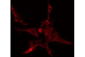 ABIN6274659 staining COLO205 cells by IF/ICC. (CYP4B1 antibody  (Internal Region))
