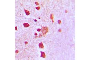 Immunohistochemical analysis of Peroxiredoxin 3 staining in human brain formalin fixed paraffin embedded tissue section. (Peroxiredoxin 3 antibody  (Center))