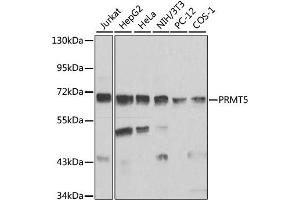 Western blot analysis of extracts of various cell lines, using PRMT5 antibody (ABIN1874327) at 1:1000 dilution. (PRMT5 antibody)