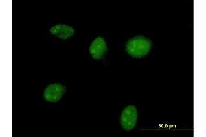 Immunofluorescence of purified MaxPab antibody to HGD on HeLa cell. (HGD antibody  (AA 1-445))