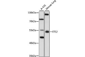 Western blot analysis of extracts of various cell lines, using SPRY3 antibody (ABIN6133259, ABIN6140325, ABIN6140326 and ABIN6223170) at 1:1000 dilution. (ETS2 antibody  (AA 160-350))