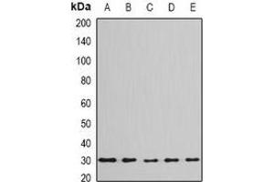 Western blot analysis of BPGM expression in Jurkat (A), Hela (B), mouse liver (C), mouse testis (D), rat brain (E) whole cell lysates. (BPGM antibody)