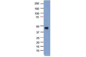 Sample Type: HEK293T cells transfected with a plasmid for over expression of myc-tagged PHF6Primary Dilution: 1:1000Secondary (goat anti-rabbit HRP) Dilution: 1:1000 (PHF6 antibody  (N-Term))