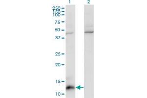 Western Blot analysis of CCL7 expression in transfected 293T cell line by CCL7 monoclonal antibody (M03), clone 4B5. (CCL7 antibody  (AA 24-99))