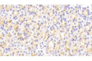 Detection of vWA1 in Rat Stomach Tissue using Polyclonal Antibody to Von Willebrand Factor A Domain Containing Protein 1 (vWA1) (VWA1 antibody  (AA 43-285))