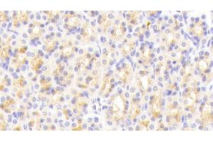 Detection of vWA1 in Rat Stomach Tissue using Polyclonal Antibody to Von Willebrand Factor A Domain Containing Protein 1 (vWA1) (VWA1 antibody  (AA 43-285))