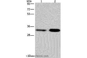Western blot analysis of Jurkat and NIH/3T3 cell, using CDK5 Polyclonal Antibody at dilution of 1:300 (CDK5 antibody)