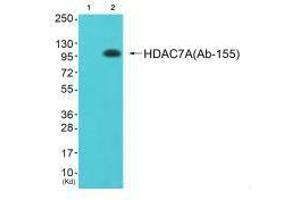 Western blot analysis of extracts from JK cells (Lane 2), using HDAC7A (Ab-155) antiobdy. (HDAC7 antibody  (Ser155))
