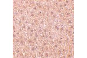 Immunohistochemistry of RYBP in mouse liver tissue with RYBP polyclonal antibody  at 10 ug/mL .
