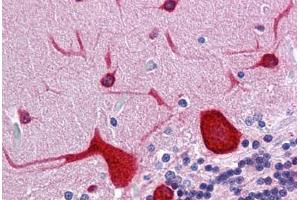 Human Brain, cerebellum: Formalin-Fixed, Paraffin-Embedded (FFPE) (EEF1A2 antibody  (AA 238-443))