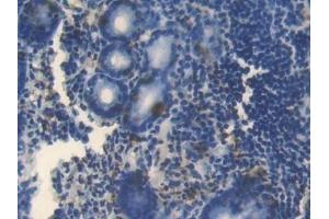 Detection of BMP4 in Human Stomach Tissue using Polyclonal Antibody to Bone Morphogenetic Protein 4 (BMP4) (BMP4 antibody  (AA 22-408))