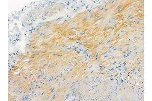 ABIN6263879 and ABIN6272762 at 1/100 staining human normal colon tissue by IHC-P.