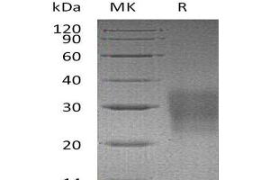 Western Blotting (WB) image for TNF Receptor Superfamily, Member 6 (FAS) protein (His tag) (ABIN7320747)