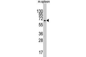 Western blot analysis of Parp3 polyclonal antibody  in mouse spleen tissue lysate (35 ug/lane). (PARP3 antibody  (C-Term))