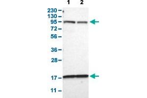 Western Blot analysis with DPP8 polyclonal antibody . (DPP8 antibody  (AA 17-135))