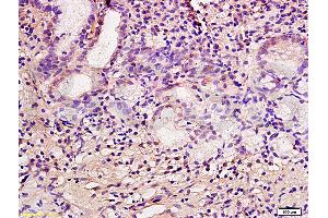 Formalin-fixed and paraffin embedded human gastric mucosa labeled with Anti-CA IX/CA9 Polyclonal Antibody, Unconjugated (ABIN752773) at 1:200 followed by conjugation to the secondary antibody and DAB staining. (CA9 antibody  (AA 251-350))