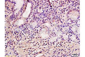 Formalin-fixed and paraffin embedded human gastric mucosa labeled with Anti-CA IX/CA9 Polyclonal Antibody, Unconjugated (ABIN752773) at 1:200 followed by conjugation to the secondary antibody and DAB staining.