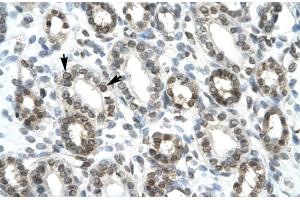 Immunohistochemistry (IHC) image for anti-Ha-Ry/enhancer-of-Split Related with YRPW Motif 1 (HEY1) (C-Term) antibody (ABIN2779686)