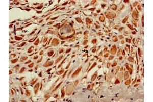 Immunohistochemistry of paraffin-embedded human placenta tissue using ABIN7168188 at dilution of 1:100 (MSK1 antibody  (AA 224-367))