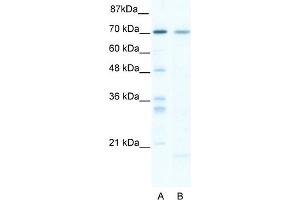 WB Suggested Anti-SOX13 Antibody Titration:  5. (SOX13 antibody  (C-Term))