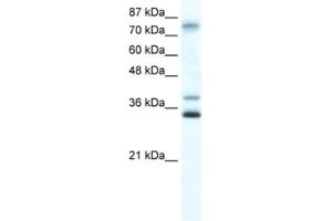 Western Blotting (WB) image for anti-Zinc Finger Protein 570 (ZNF570) antibody (ABIN2461299) (ZNF570 antibody)