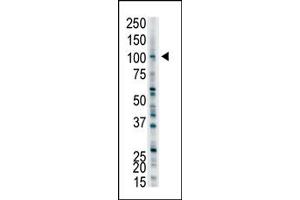 Image no. 1 for anti-Ubiquitin Protein Ligase E3A (ube3a) (C-Term) antibody (ABIN357571) (ube3a antibody  (C-Term))