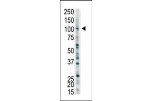 Image no. 1 for anti-Ubiquitin Protein Ligase E3A (ube3a) (C-Term) antibody (ABIN357571)
