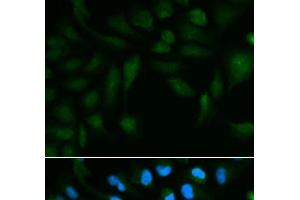 Immunofluorescence analysis of HepG2 cells using EPPIN Polyclonal Antibody (Eppin antibody)