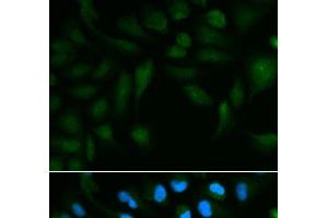Immunofluorescence analysis of HepG2 cells using EPPIN Polyclonal Antibody