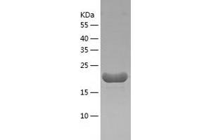 Western Blotting (WB) image for Adaptor-Related Protein Complex 3, sigma 1 Subunit (AP3S1) (AA 1-193) protein (His tag) (ABIN7288180) (AP3S1 Protein (AA 1-193) (His tag))