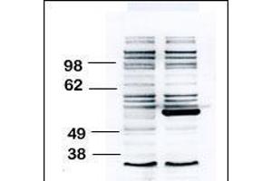 Western Blotting (WB) image for anti-B Lymphoid Tyrosine Kinase (BLK) (AA 1-30), (N-Term) antibody (ABIN392087)