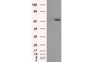 HEK293T cells were transfected with the pCMV6-ENTRY control (Left lane) or pCMV6-ENTRY HDAC10 (Right lane) cDNA for 48 hrs and lysed. (HDAC10 antibody)