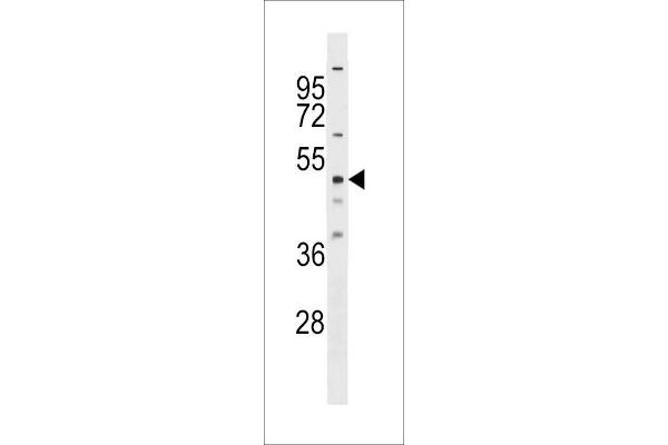 RBM23 Antikörper  (AA 128-157)