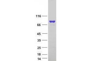 Validation with Western Blot (VWA5A Protein (Transcript Variant 3) (Myc-DYKDDDDK Tag))