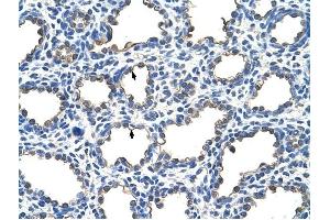 EMP2 antibody was used for immunohistochemistry at a concentration of 4-8 ug/ml to stain Alveolar cells (arrows) in Human Lung. (EMP2 antibody  (Middle Region))