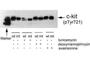 Western blot analysis of extracts from 293T cells(transfected with wild or mutant type c-kit/pc DNA3. (KIT antibody  (pTyr721))