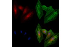 ABIN6260564 and ABIN6278557 staining  cells by IF/ICC.