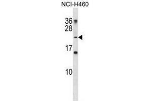 TNNI2 Antibody (N-term) western blot analysis in NCI-H460 cell line lysates (35 µg/lane). (TNNI2 antibody  (N-Term))