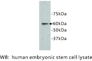 Image no. 1 for anti-Frizzled Family Receptor 5 (FZD5) antibody (ABIN1112891) (FZD5 antibody)