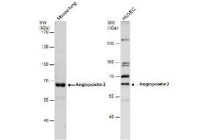 WB Image Angiopoietin 2 antibody detects Angiopoietin 2 protein by western blot analysis. (Angiopoietin 2 antibody)