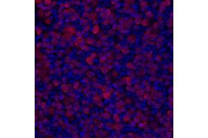 Immunostaining of mouse retinal ganglion cells showing specific immunolabeling of RBPMS in red. (RBPMS antibody  (N-Term))