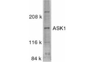 Image no. 1 for anti-Mitogen-Activated Protein Kinase Kinase Kinase 5 (MAP3K5) (C-Term) antibody (ABIN318975) (ASK1 antibody  (C-Term))