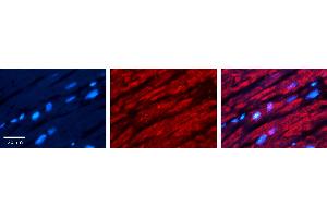 Rabbit Anti-CRY2 Antibody Catalog Number: ARP52398_P050 Formalin Fixed Paraffin Embedded Tissue: Human heart Tissue Observed Staining: Cytoplasmic Primary Antibody Concentration: 1:100 Other Working Concentrations: N/A Secondary Antibody: Donkey anti-Rabbit-Cy3 Secondary Antibody Concentration: 1:200 Magnification: 20X Exposure Time: 0.