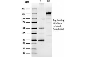 SDS-PAGE Analysis Purified Prolactin Mouse Monoclonal Antibody (PRL/2910). (Prolactin antibody  (AA 63-201))