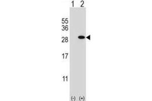 Western Blotting (WB) image for anti-Glutathione S-Transferase theta 1 (GSTT1) antibody (ABIN2997016) (GSTT1 antibody)