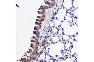 Immunohistochemistry of paraffin-embedded mouse lung using A Rabbit pAb (ABIN7265731) at dilution of 1:100 (40x lens).
